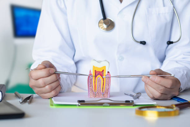 Best Knocked-Out Tooth (Avulsed Tooth) Treatment in Prince Frederick, MD